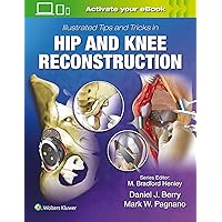 Harborview Illustrated Tips and Tricks in Fracture Surgery