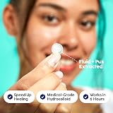 Patch Perfect Spot Patches 102 Count Korean Hydrocolloid Pimple Patches view 2