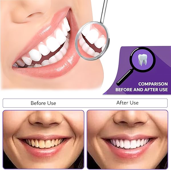 AWANOVA 30ML PURPLE TOOTHPASTE FOR TEETH WHITENING, COLOR CORRECTOR TOOTHPASTE, ADVANCED STAIN REMOVAL, HEALTHY SMILE, CONFIDENT YOU WITH PURPLE TEETH WHITENING GEL, COLOUR CORRECTOR