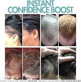 Hair Genetics Hair Fibres Refill Packs for Bald Spots Natural Colours view 4