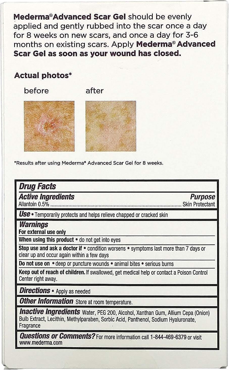Mederma Advanced Scar Gel, 1.76 oz (50 g): Health & Personal Care