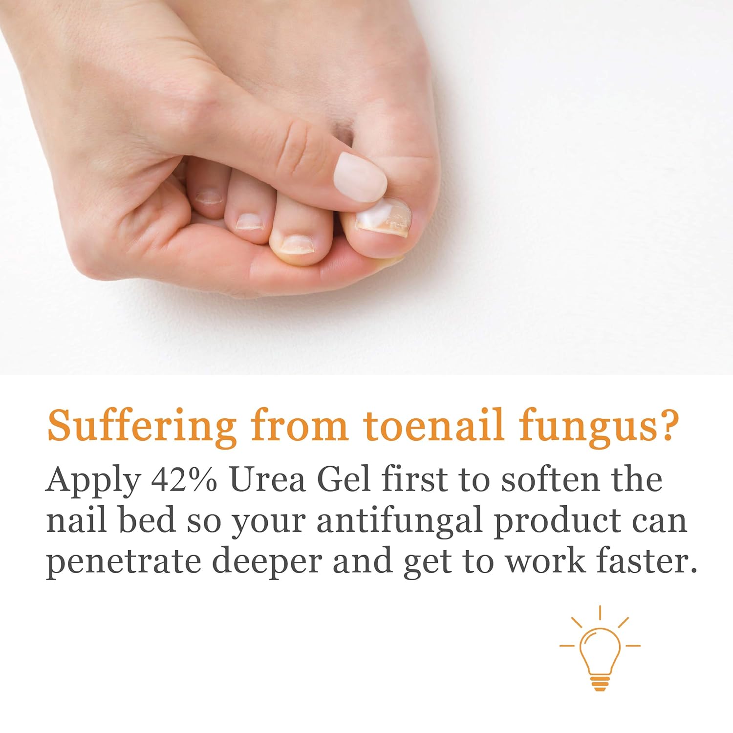Maximum Strength 42% Urea Foot Gel, Moisturizes Callus Cracked Rough Dry Dead Skin and Corns, Softens Thick Painful Nails with Salicylic and Hyaluronic Acid (1 Jar) : Beauty