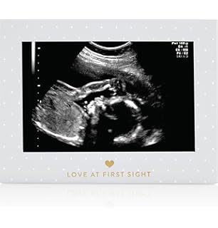 Amazon Com Pearhead Triple Sonogram Pregnancy Frame Watch Baby Grow Through All Three Trimesters Baby Shower Or Christmas Gift For Expecting Parents White Baby