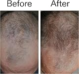 The INKEY List Caffeine Scalp Serum Hair Loss Reduction Overnight Treatment view 5