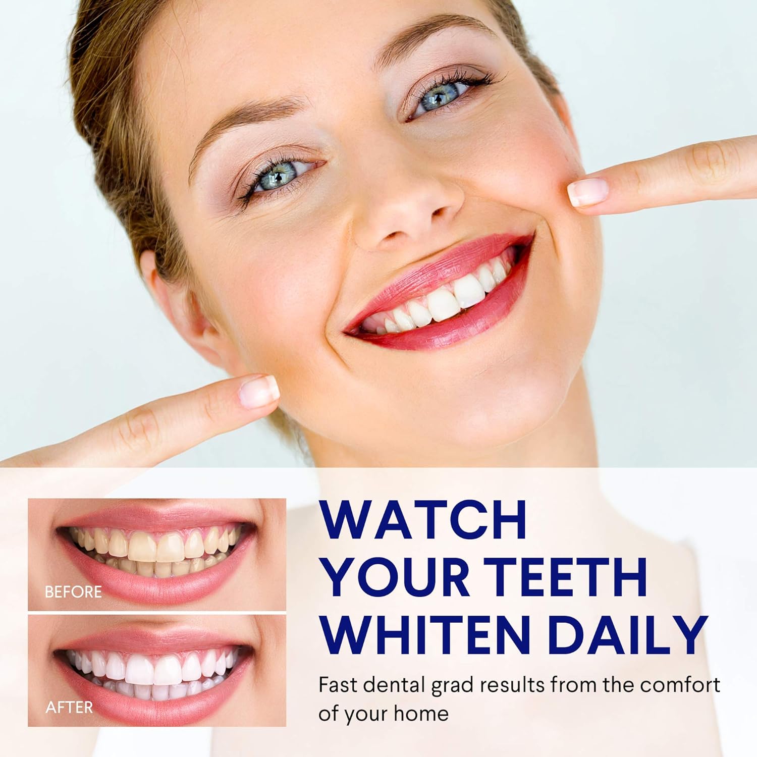 VieBeauti Teeth Whitening Kit - 5X LED Light Tooth Whitener with 35% Carbamide Peroxide, Mouth Trays, Remineralizing Gel and Tray Case - Built-In 10 Minute Timer Restores Your Gleaming White Smile: Beauty