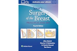 Spear's Surgery of the Breast: Principles and Art