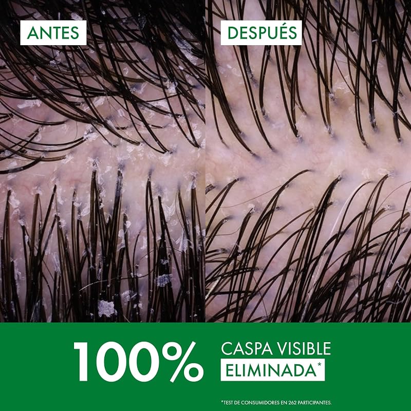 Shampoo Anticaspa, Cabelos Oleosos, Elimina a Caspa e Reduz a Coceira, Couro Cabeludo Limpo e Saudável, Dupla Eficácia, Unissex, Técnica Dercos, 200 ml