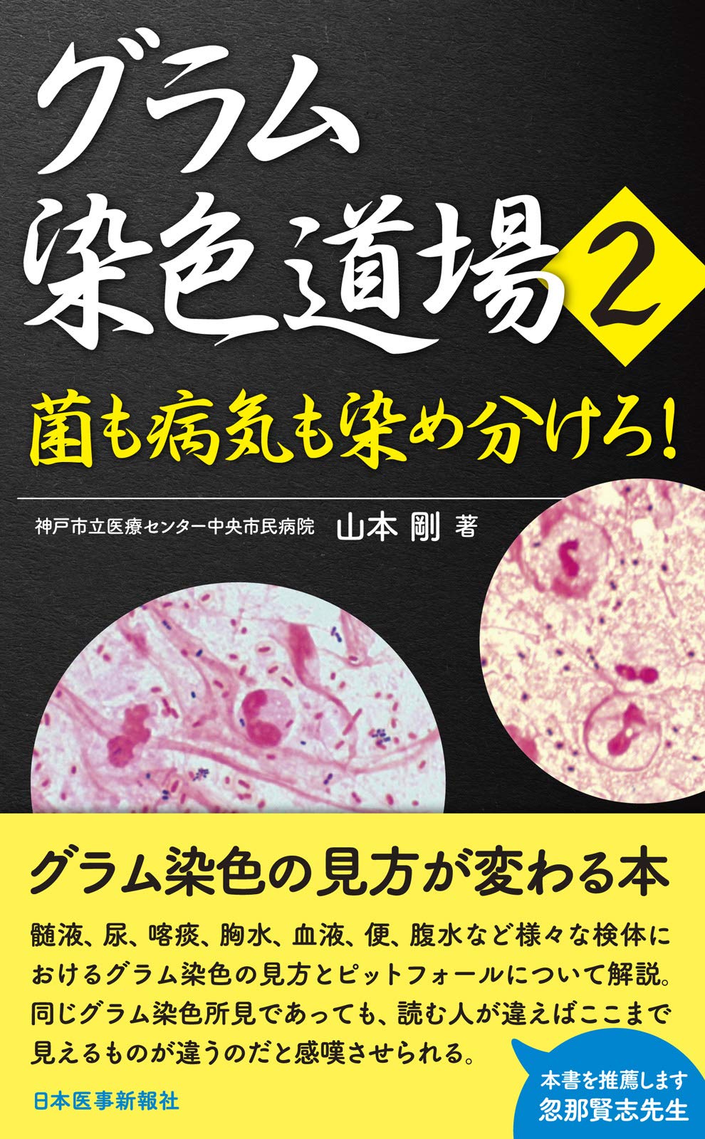 グラム染色道場2 菌も病気も染め分けろ 剛 山本 本 通販 Amazon