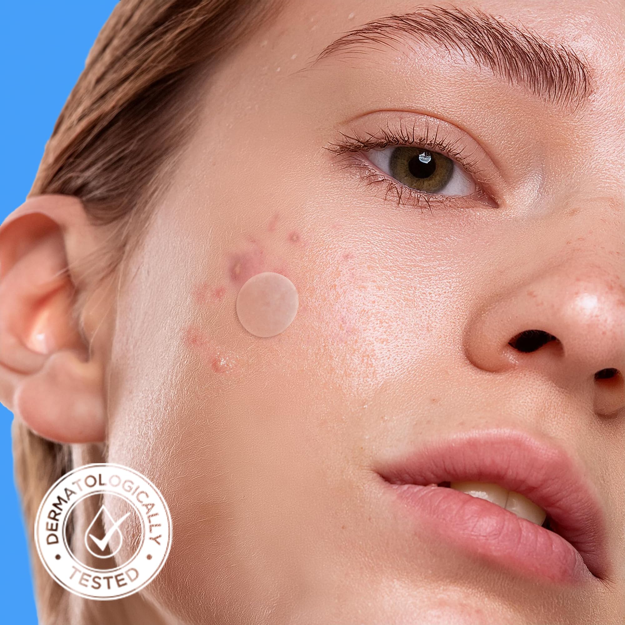 AVARELLE Acne Cover Patches, Eligible Hydrocolloid Pimple Patches for Face with Tea Tree Oil, Korean Skincare Zit Patches for Face | HSA Store Eligible Items | Vegan, Cruelty-free