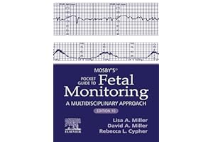 Mosby's® Pocket Guide to Fetal Monitoring - E-Book (Nursing Pocket Guides)