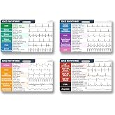 EKG Rhythm Interpretation Badge Card Set with 24 Common Cardiac Rhythms | EKG Rhythm Cheat Sheet Reference Guide, Easy Recognition, Pocket-sized Badge Cards for Nurses EMTs Paramedics