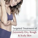Eucerin Roughness Relief Spot Treatment 2.5 oz Dry Scaly Skin Urea Exfoliating view 4