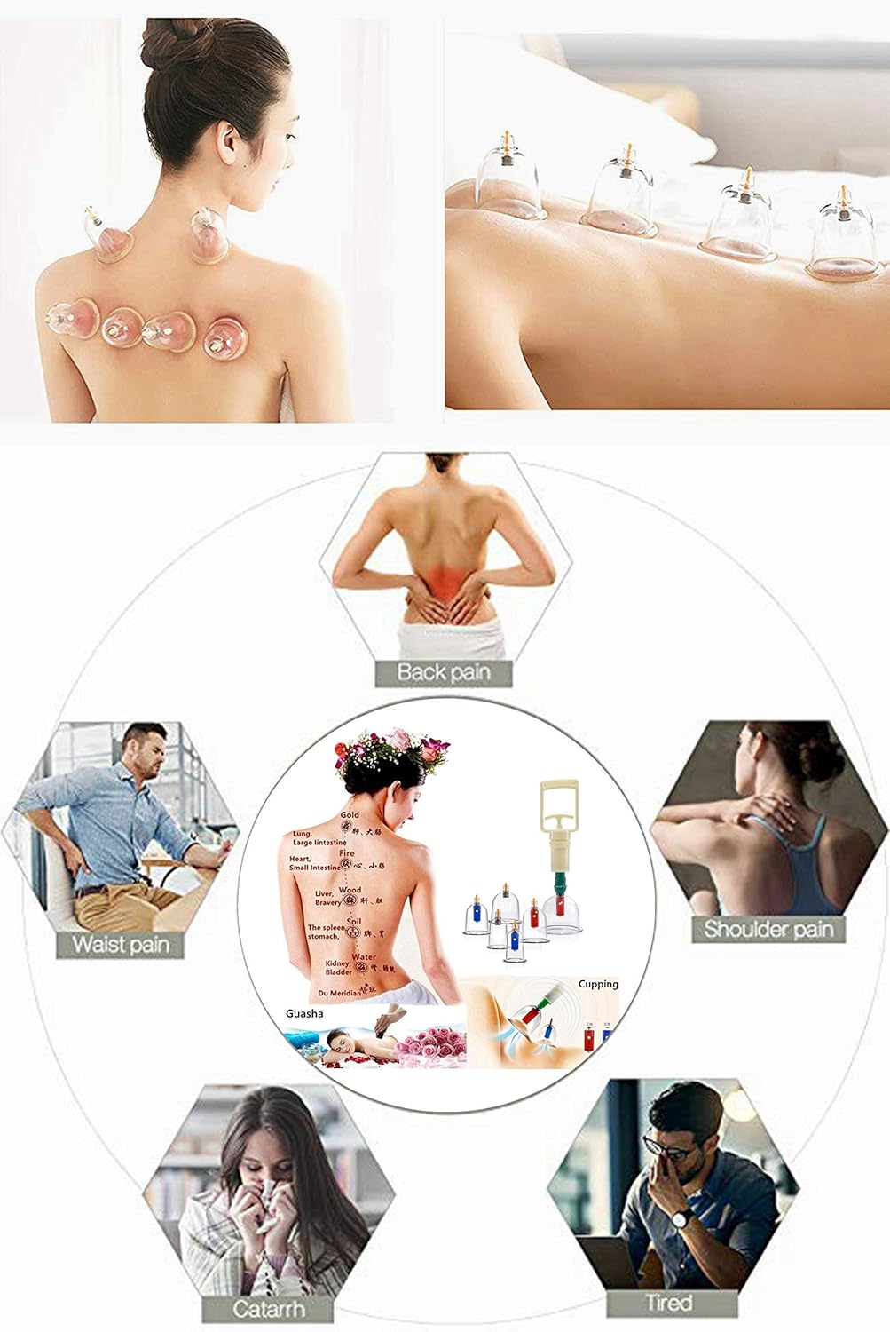 Med SPA Care Handheld Vacuum Cupping Set/Head Massager/Full Body Massager/Best Fat Burnersr- Chinese Ancient Acupuncture Therapy for Back Pain, Lose Belly Fat Fast, Value Gifts (Luxury 24-Cups Set): Sports & Outdoors
