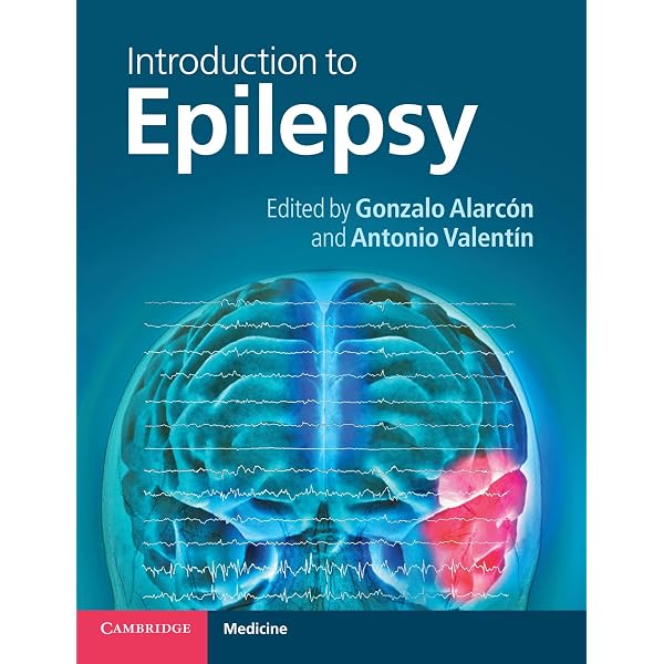 Epilepsy: A Comprehensive Textbook (3-volume set): 9780781757775