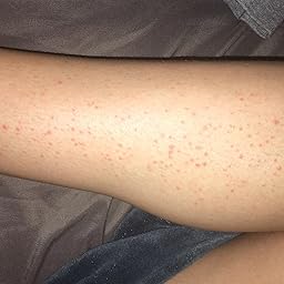 Amazon Com Tend Skin After Shave Solution For Ingrown Hairs