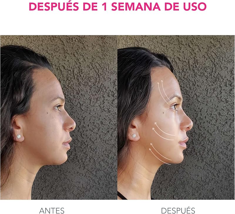 BEAR Masajeador facial eléctrico de microcorrientes - Define el contorno de la mandíbula - Lifting facial no invasivo - Anti arrugas - Seguro e indoloro - Fuchsia