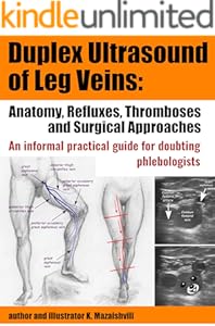 kindle best category lists