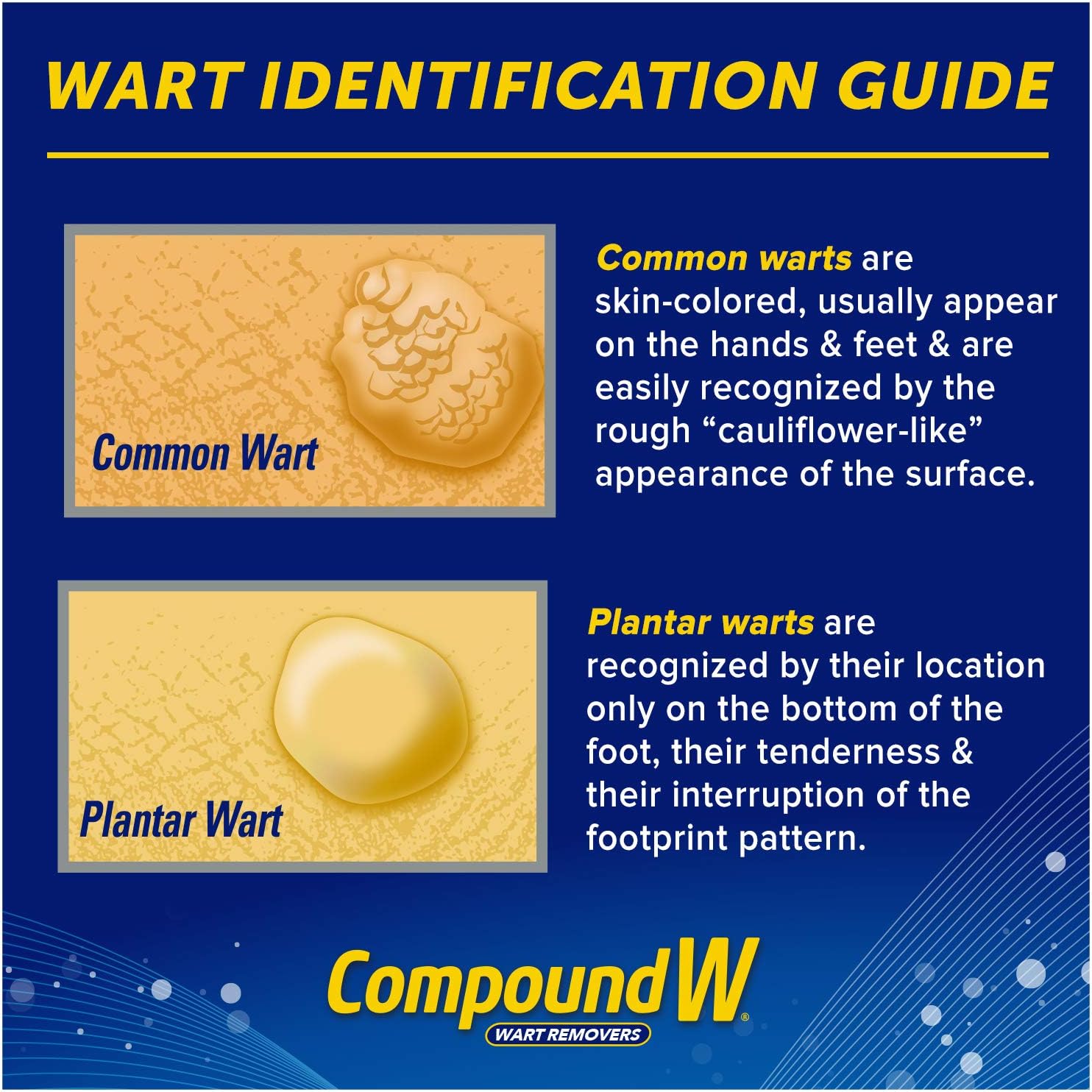 Compound W Freeze Off | Wart Removal | 8 Applications: Health & Personal Care