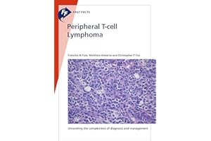 Fast Facts: Peripheral T-cell Lymphoma: Unraveling the Complexities of Diagnosis and Management