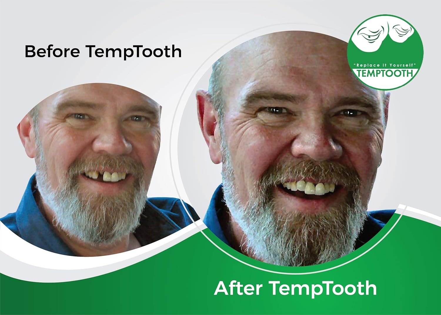 Temptooth #1 Seller Trusted Patented Temporary Tooth Replacement Product: Health & Personal Care