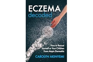 Eczema Decoded: How to Rescue Yourself or Your Children from Atopic Dermatitis