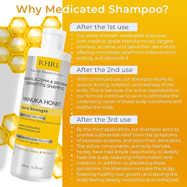 RIDA HAIR RESEARCH INSTITUTE PSORIASIS SHAMPOO FOR MEN & WOMEN | ITCHY SCALP TREATMENT WITH MANUKA HONEY | BEST FOR ECZEMA, SEBORRHEIC DERMATITIS, RINGWORM & FOLLICULITIS SCALP TREATMENT
