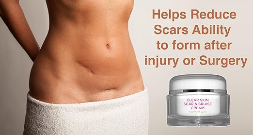 5 Foods To Lose Belly Fat