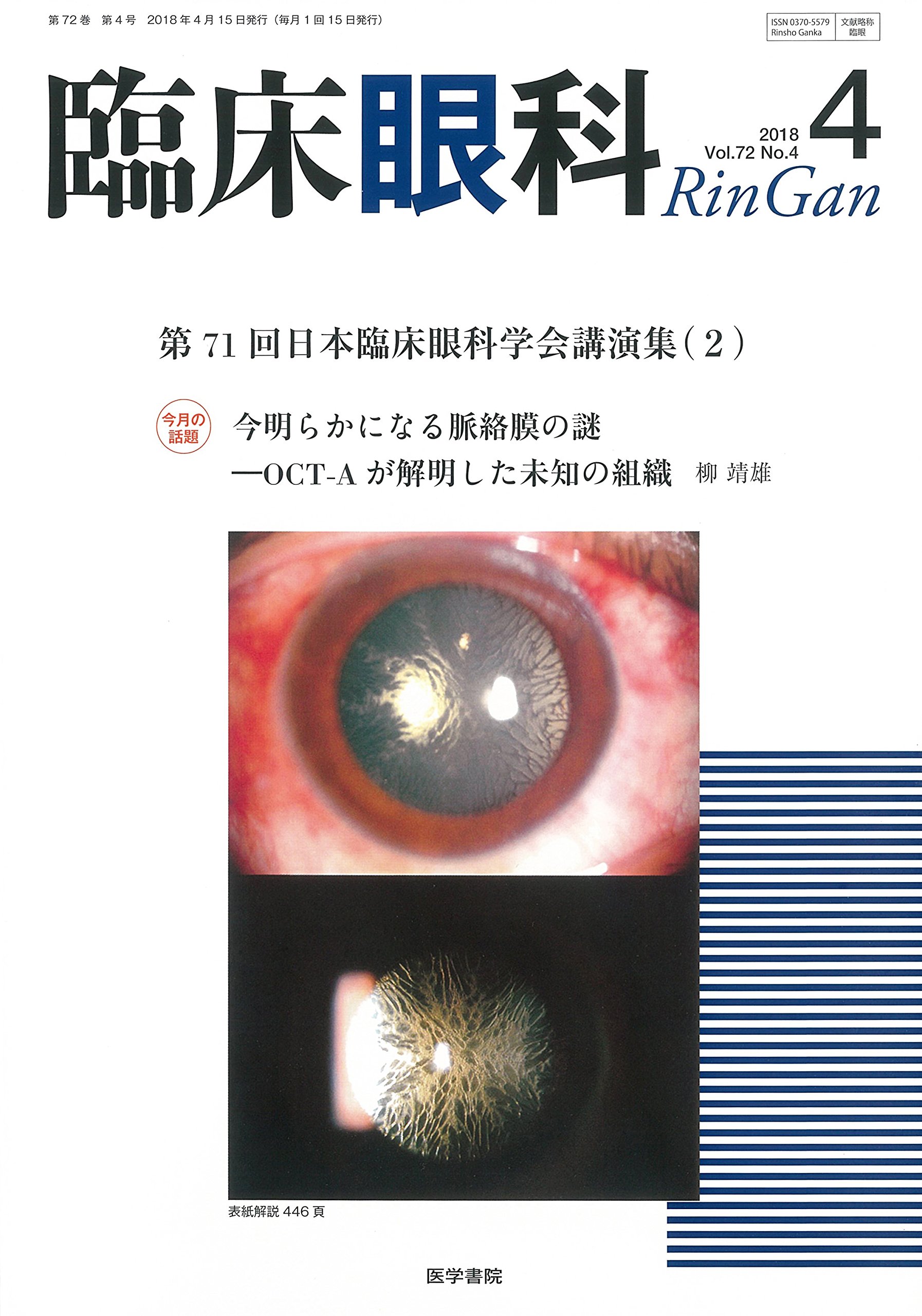 臨床眼科 2018年 4月号 特集 第71回日本臨床眼科学会講演集 2 本 通販 Amazon