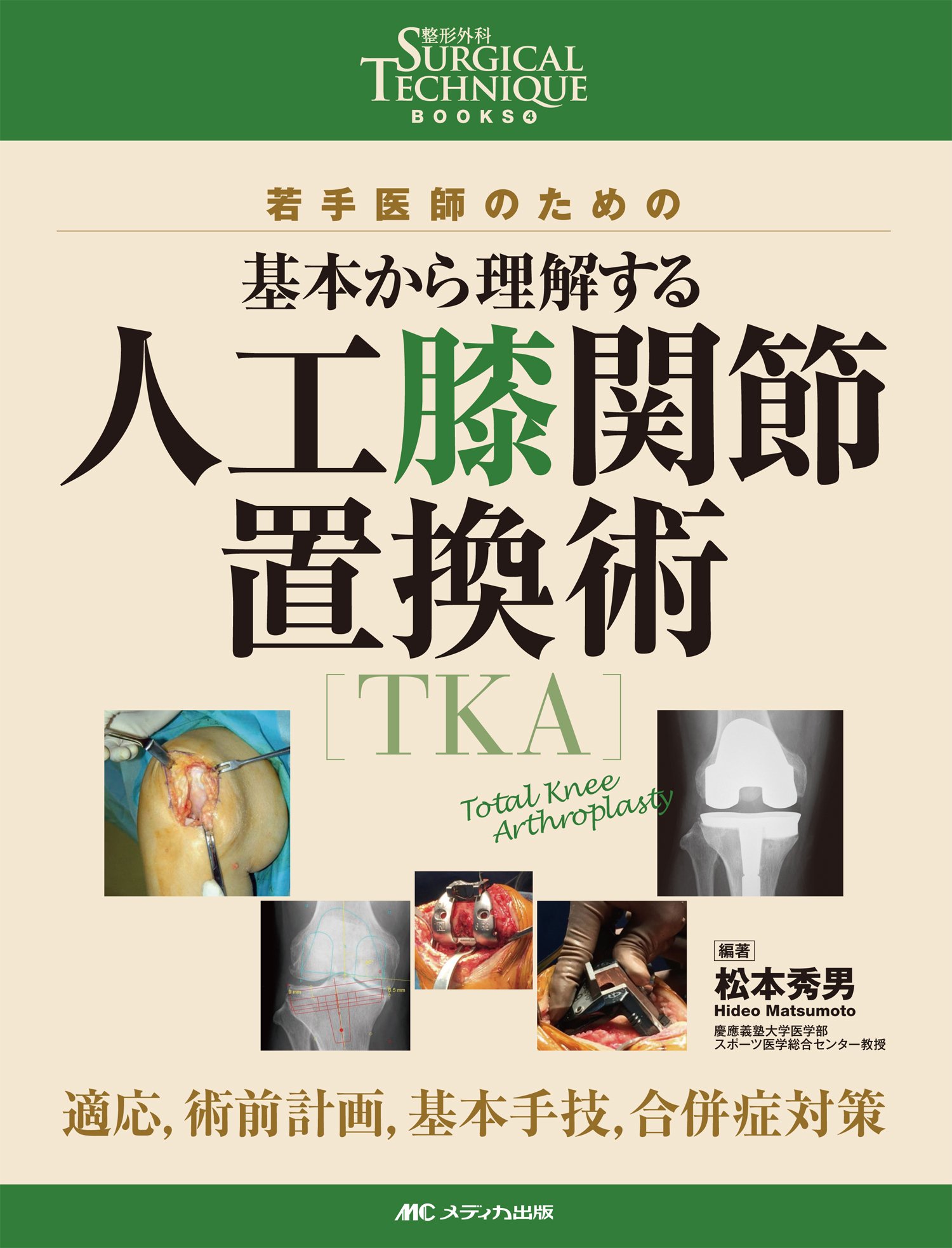 人工膝関節置換術[TKA]のすべて S115803486 - 健康・医学快適