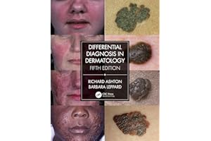 Differential Diagnosis in Dermatology