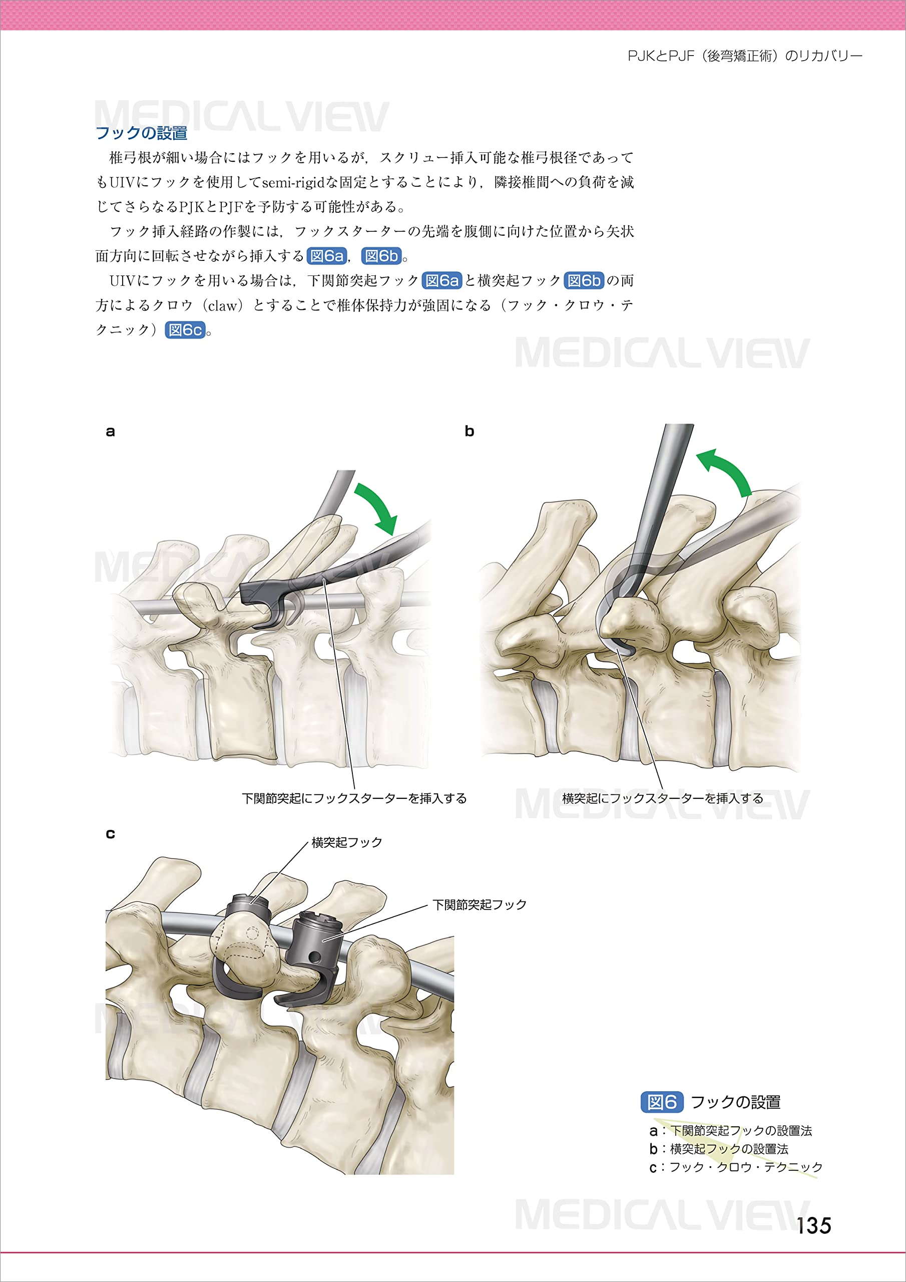 脊椎手術と合併症 回避の技とトラブルシューティング Os Nexus 電子版付き 14 Amazon Com Books 脊椎手術と合併症 回避の技とトラブルシューティング Os Nexus 電子版付き 14 Amazon Com Books