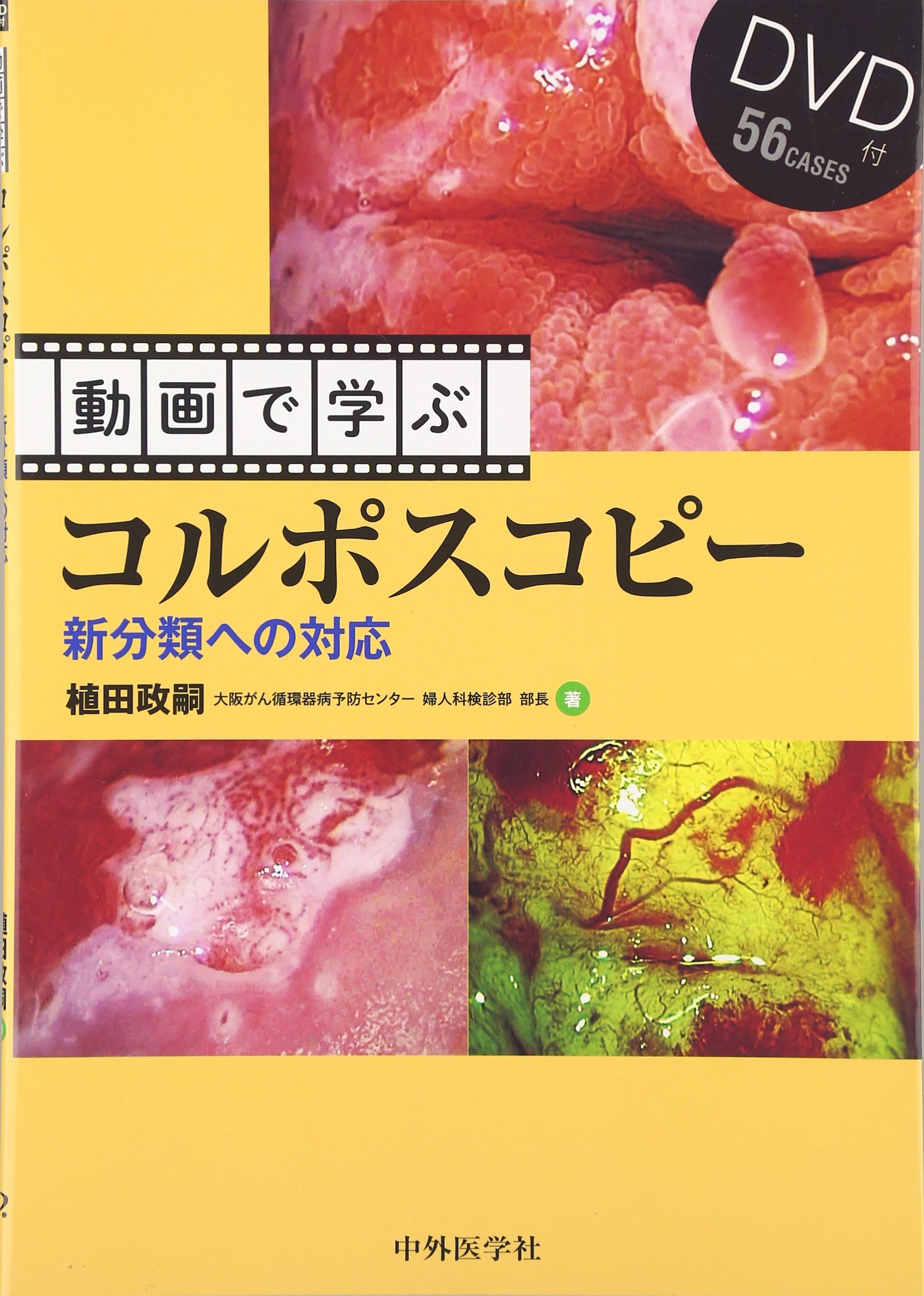 動画で学ぶコルポスコピー 新分類への対応 植田政嗣 本 通販 Amazon