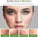 Freshskin Beauty 500g Aloe Vera Gel 99% Bio-Active Cruelty Free Vegan view 4