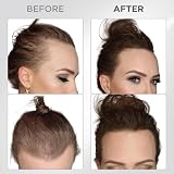 THICK FIBER Hair Fibres 25g Dark Brown Thickening Hair Powder view 5
