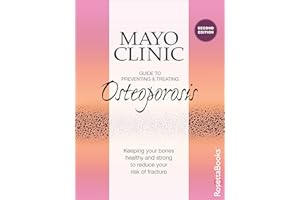 Mayo Clinic Guide to Preventing & Treating Osteoporosis: Keeping Your Bones Healthy and Strong to Reduce Your Risk of Fractur