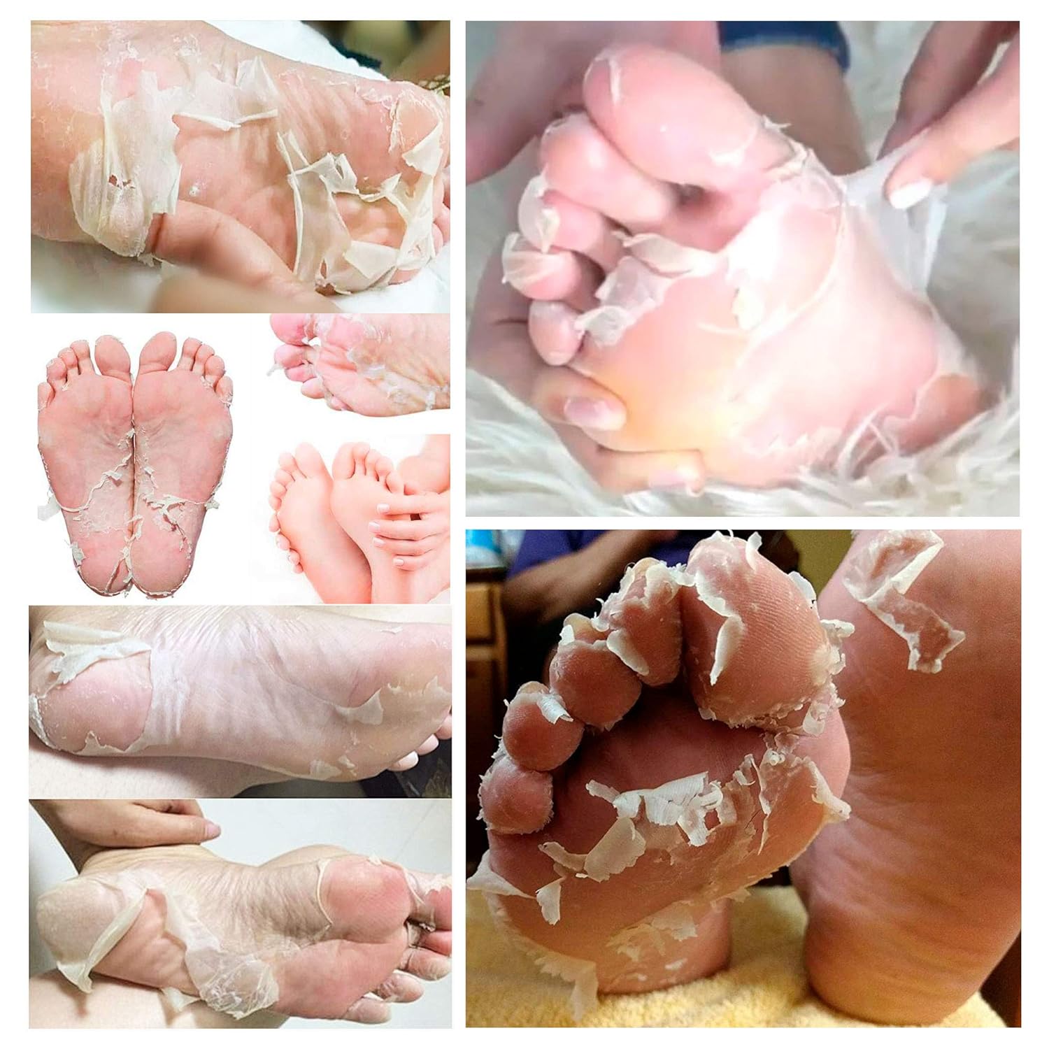 Voglily Foot Peel Mask Exfoliating Booties for Peeling Off Calluses & Dead Skin, Exfoliant for Soft baby Feet, Men & Women Upadted Version 2 Pack: Beauty