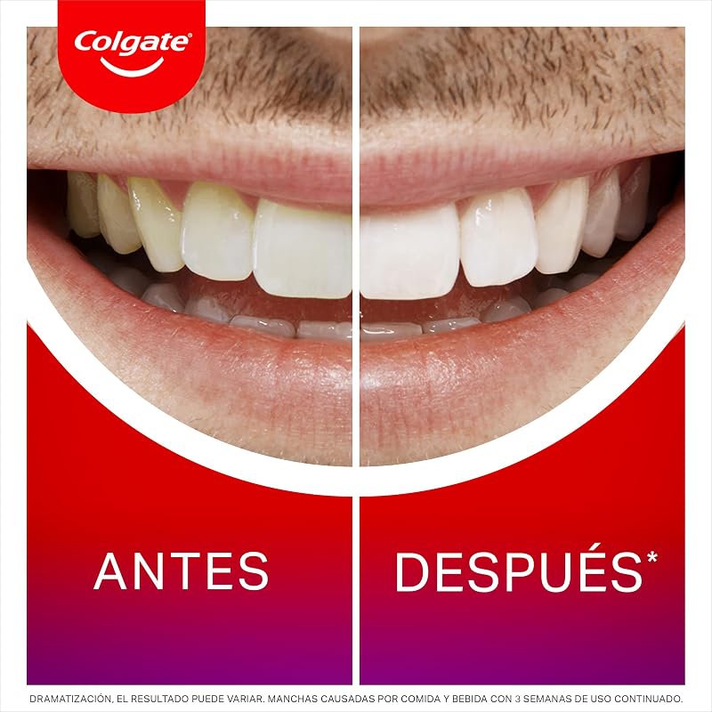 Max White Night Sérum Branqueador (2.5ml) | Branqueador de Dentes em Casa | Revele 3 tons de branco* enquanto dorme | Novo aplicador melhorado | Esmalte Seguro