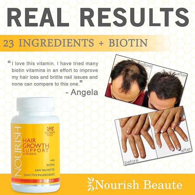 Nourish Beaute Hair Growth Vitamins For Hair Loss And Thinning That Promotes Regrowth For Men And Women 1 Bottle Of 60 Tablets