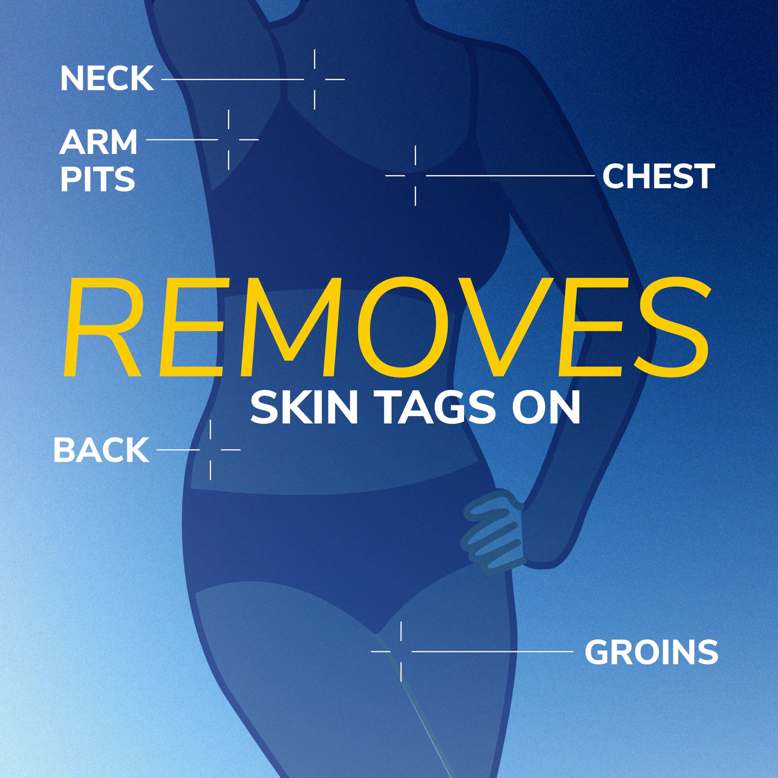 Dr. Scholl's Freeze Away Skin Tag Remover Kit, 8 ct – Completely removes Skin Tags in As Little As 1 Treatment, FDA-Cleared & Clinically Proven At-Home Removal, Easy 1-Handed Action, Permanent Results