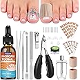 Ingrown Toenail Treatment, Professional Ingrown Toenail Removal Kit Includes Ingrown Toenail Corrector Drops, Corrector Patch, Toenail Clipper, Nail File Lifter Pedicure Tools