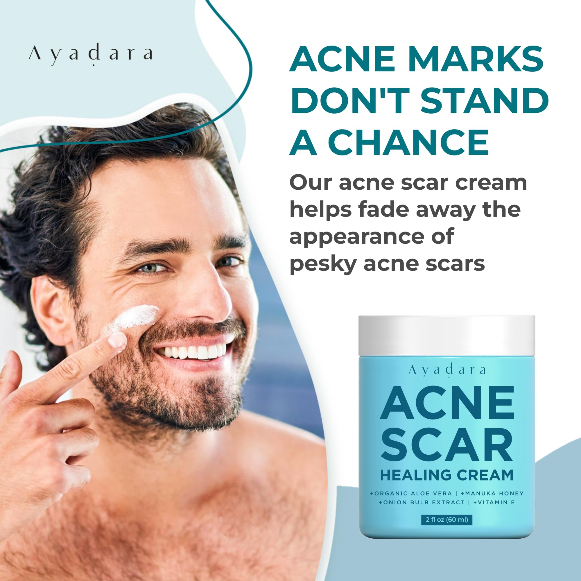Ayadara Acne Scar Healing Cream, 2 fl oz, Acne Scar Treatment for Face