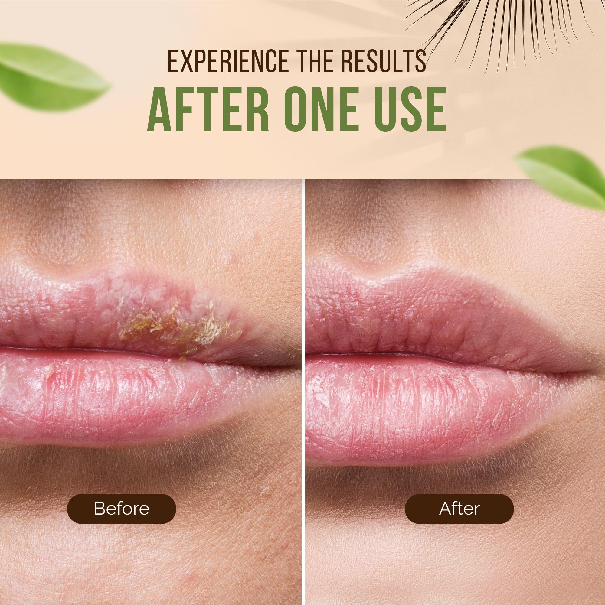 Teliaoils Lemon Balm Salve, Fast Acting/Natural Salve. Cold Sores - Skin Rashes - Irritated Skin - Itchy Skin. (1.7 Oz / 50 Ml)