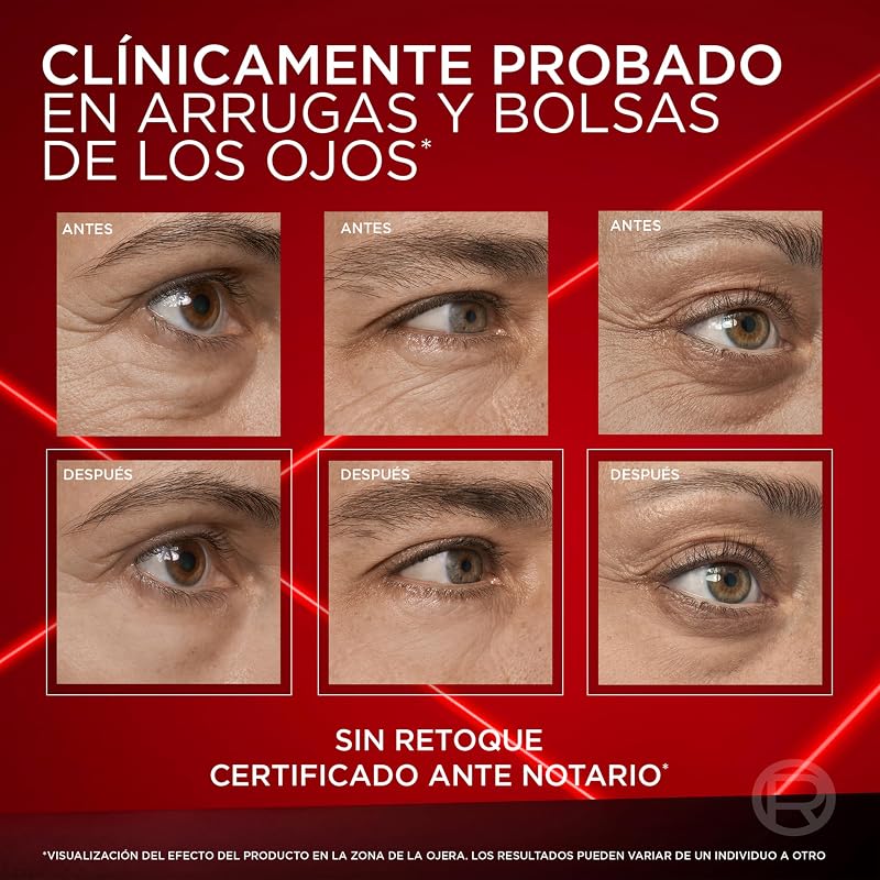 L'Oréal Paris Revitalift Laser Borrador de Bolsas de Ojos Instantáneo, 15ml