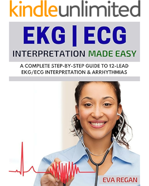 Amazon Com Ekg Ekg Interpretation Made Easy A Complete Step By Step Guide To 12 Lead Ekg Ecg Interpretation Arrhythmias Ekg Book Ekg Interpretation Nclex Nclex Rn Nclex Review Ebook Regan Eva Kindle Store