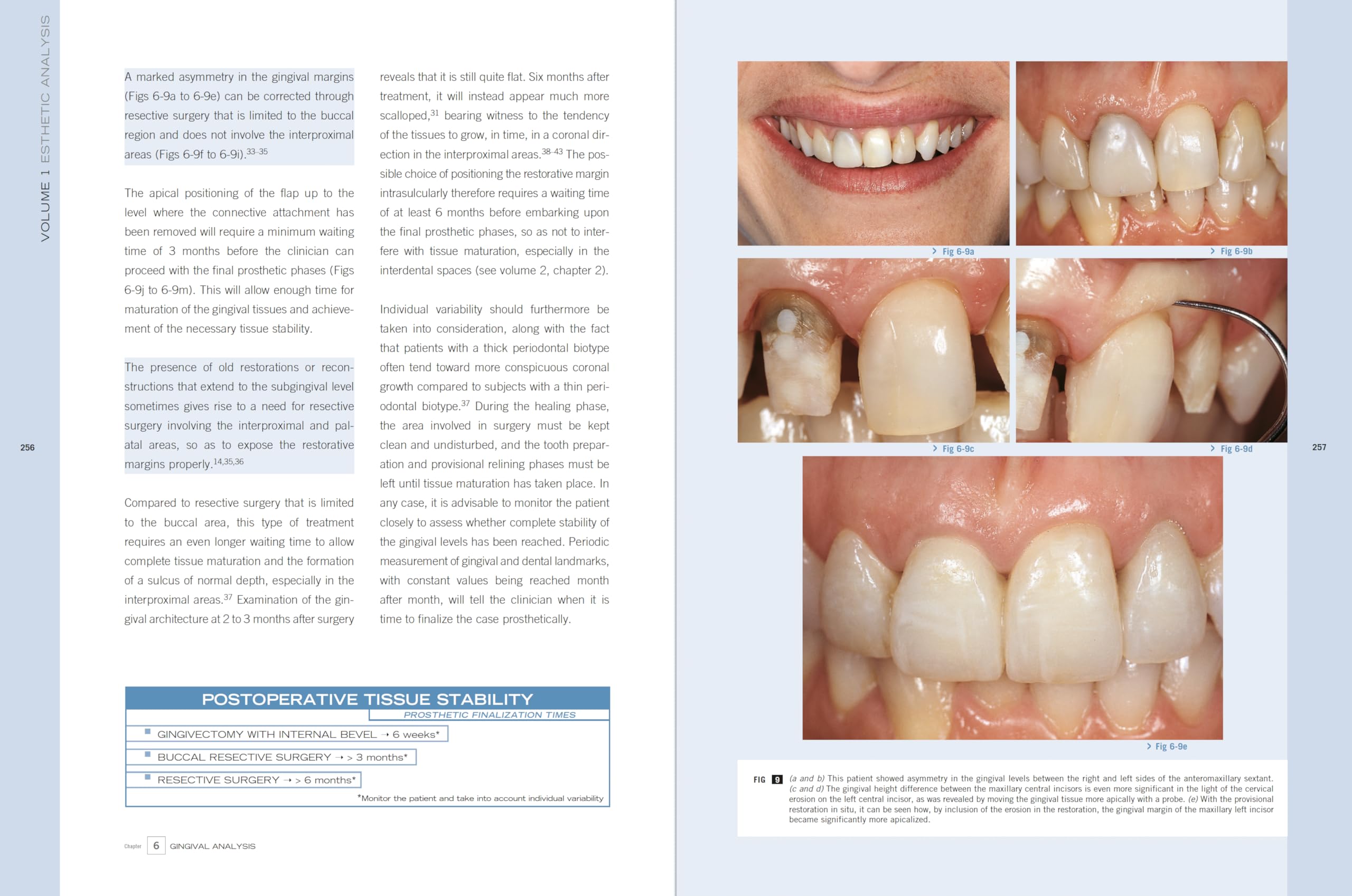 Esthetic Rehabilitation In Fixed Prosthodontics: Esthetic Analysis: A Systematic Approach To Prosthetic Treatment Esthetic Rehabilitation In Fixed Prosthodontics: Esthetic Analysis: A Systematic Approach To Prosthetic Treatment Hardcover