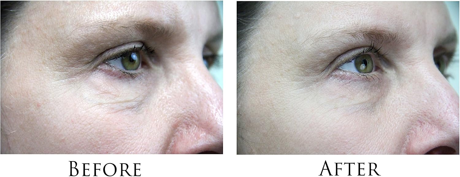7E Myolift Face Lifting Device, Mini Microcurrent Facial Device for Face Stimulation Non-Invasive, Anti-Aging - Image 5