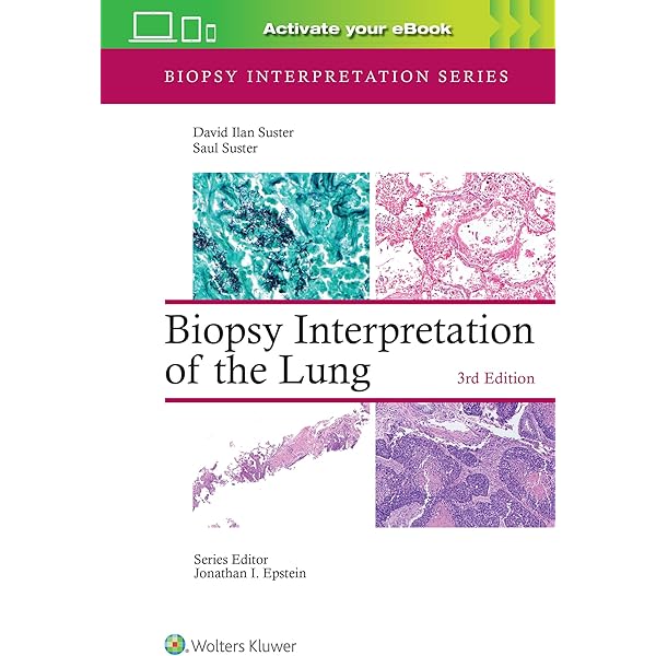 Amazon.com: Survival Guide to Thoracic Pathology: 9798986743509