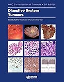 Digestive System Tumours: WHO Classification of