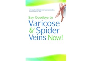 Say Goodbye to Varicose & Spider Veins Now!