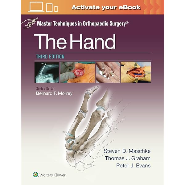 Master Techniques in Orthopaedic Surgery: The Hand: 9781451182781